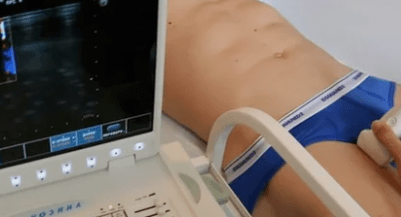 Diagnostic options for varicose veins of lower limbs
